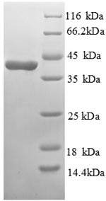 SDS-PAGE