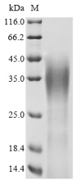 SDS-PAGE