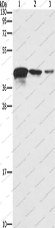 Вестерн-блоттинг, TWF2, ткань эндометриальной карциномы человека и клеточные линии A172 и U937