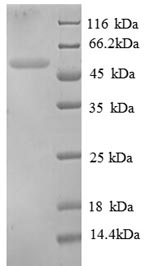 SDS-PAGE