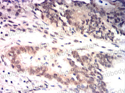 Валидация AntibodySystem RHE05805