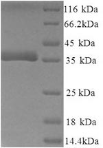 SDS-PAGE