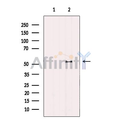 Валидация Affinity AF4646 - 2258