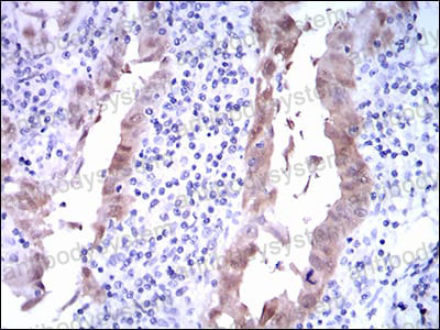 Валидация AntibodySystem RHE37707