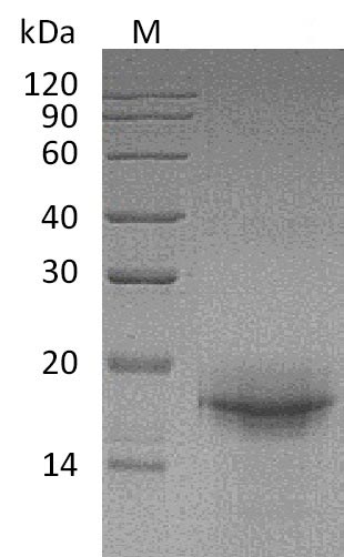 SDS-PAGE