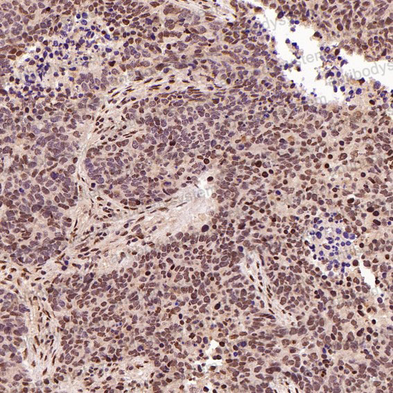 Валидация AntibodySystem RHJ51602 (3446)