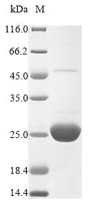 SDS-PAGE