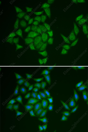 Иммунофлуоресценция, AMPD3, клетки HeLa