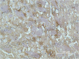 Валидация AntibodySystem RHD25706