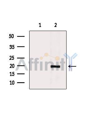Валидация Affinity AF6794 - 4035