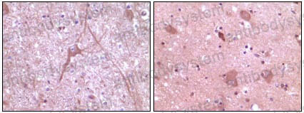 Валидация AntibodySystem RHE77702