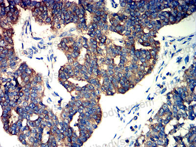 Валидация AntibodySystem RHD40502 (1564)