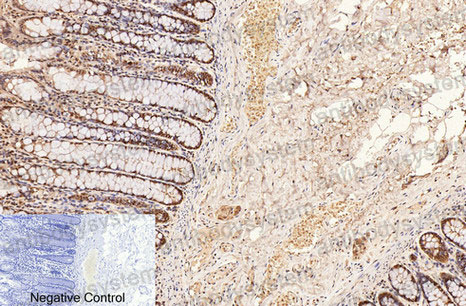 Валидация AntibodySystem RHC20801 (768)