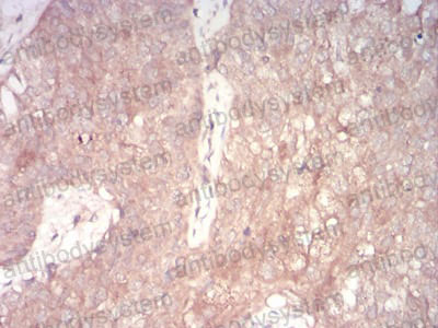 Валидация AntibodySystem RHJ63502