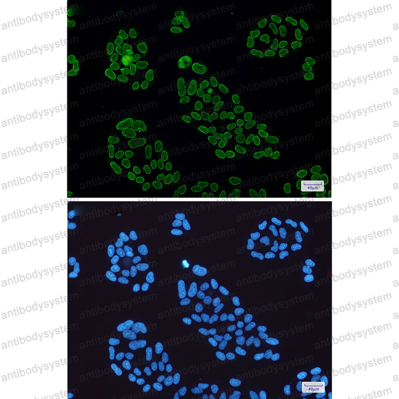 Валидация IF - AntibodySystem RHB98201