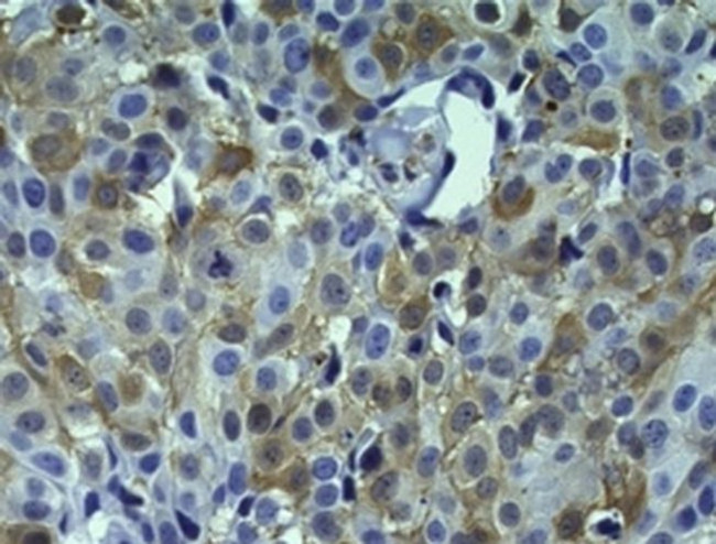 Валидация AssayVector ARM1464(1360)