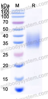 AHD46502, SDS-PAGE