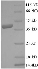 SDS-PAGE