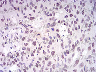 Валидация AntibodySystem RHD69905