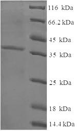 SDS-PAGE