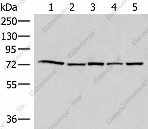 Вестерн-блоттинг, ATMIN, клеточные линии 293T, HeLa, HepG2, 231 и TM4