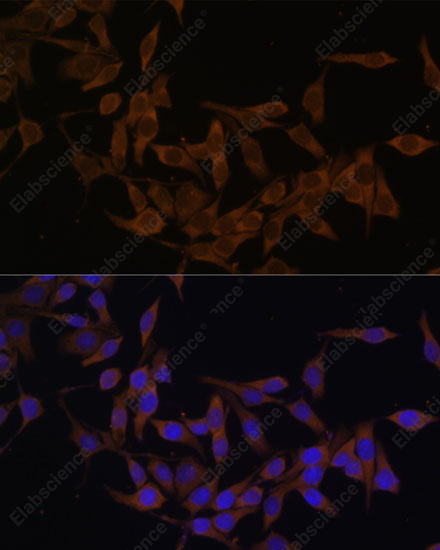 Иммунофлуоресценция, UBE2L3, клетки HeLa