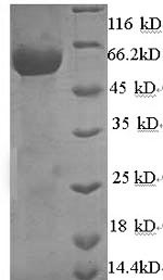 SDS-PAGE