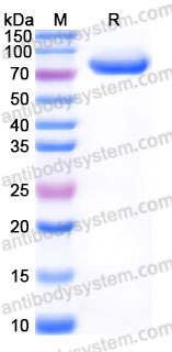 EHC81101, SDS-PAGE