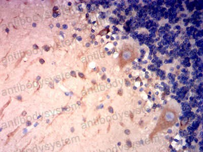 Валидация AntibodySystem RHN98102