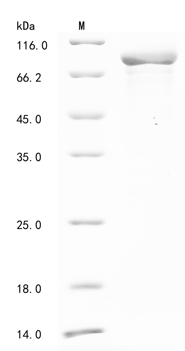 SDS-PAGE