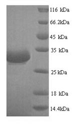 SDS-PAGE