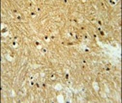 Валидация AssayVector ARM1051(143)