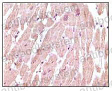 Валидация AntibodySystem RHD33902