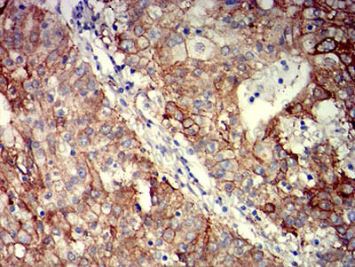 Валидация AntibodySystem RHD15401