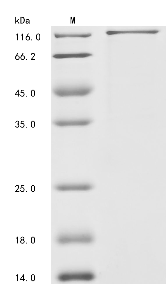 SDS-PAGE