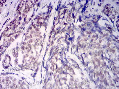 Валидация AntibodySystem RHA88905