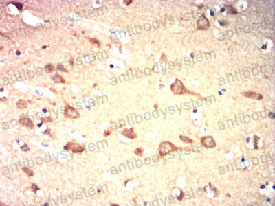 Валидация AntibodySystem RHN98202