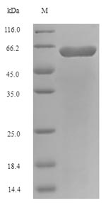 SDS-PAGE