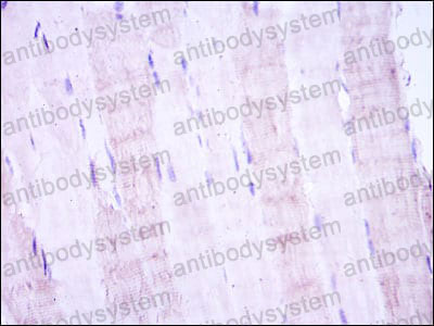 Валидация AntibodySystem RHE46003