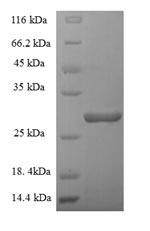 SDS-PAGE