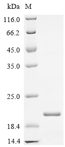 SDS-PAGE