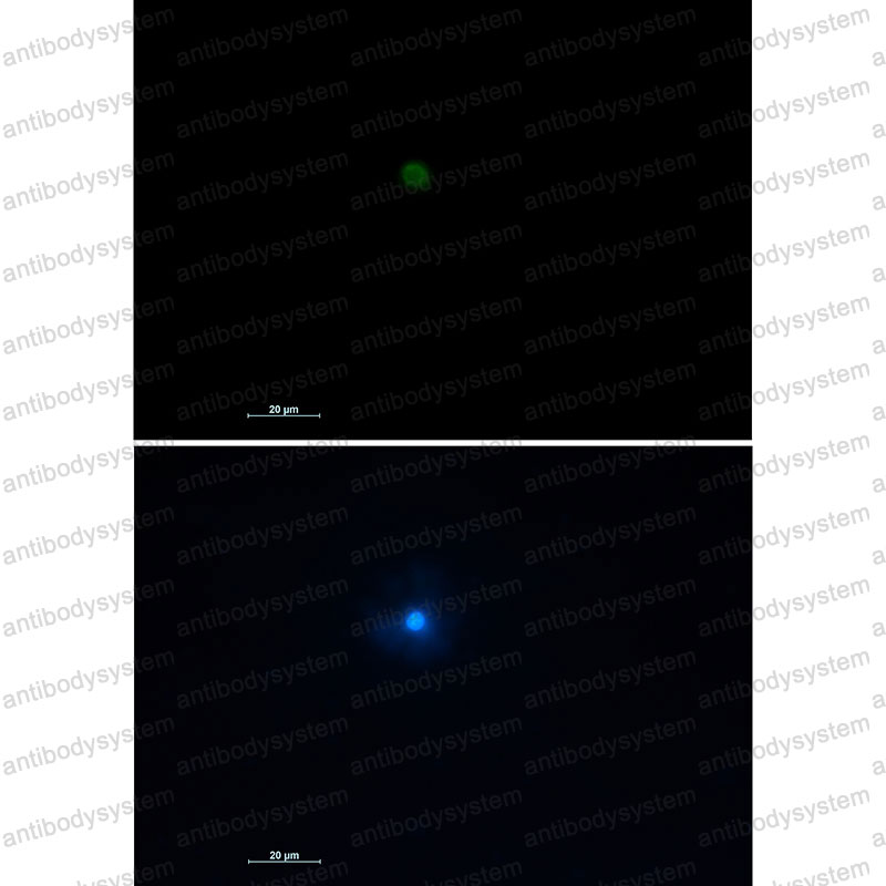 Валидация IF - AntibodySystem RHD46401