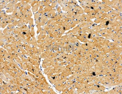 Валидация Affinity DF9963 - 22987