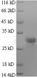 SDS-PAGE
