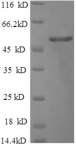 SDS-PAGE