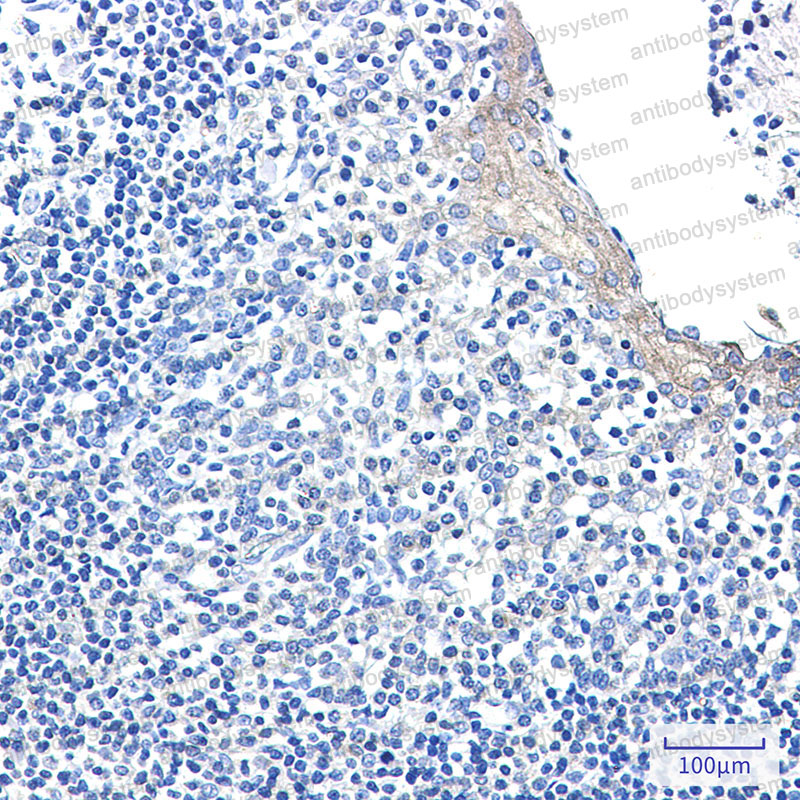 Валидация AntibodySystem RHD90601
