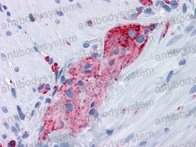 Валидация AntibodySystem RHC32202