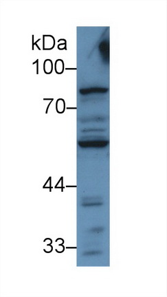 13116