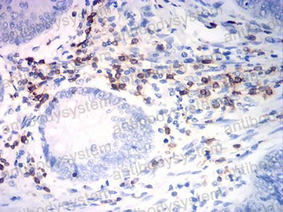 Валидация AntibodySystem RHC41805 (1017)