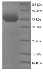 SDS-PAGE